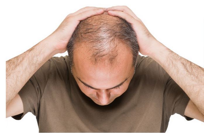بهترین روش های رشد مو و جلوگیری از ریزش مو